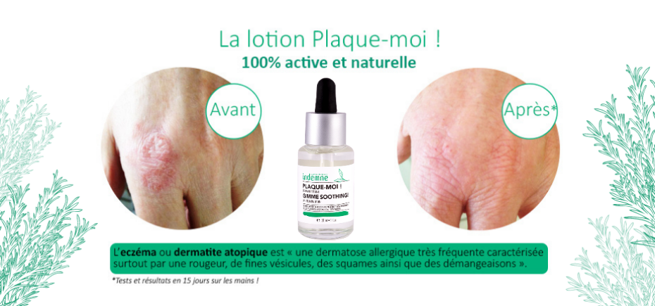 Résultats avant/après lotion Plaque-moi !